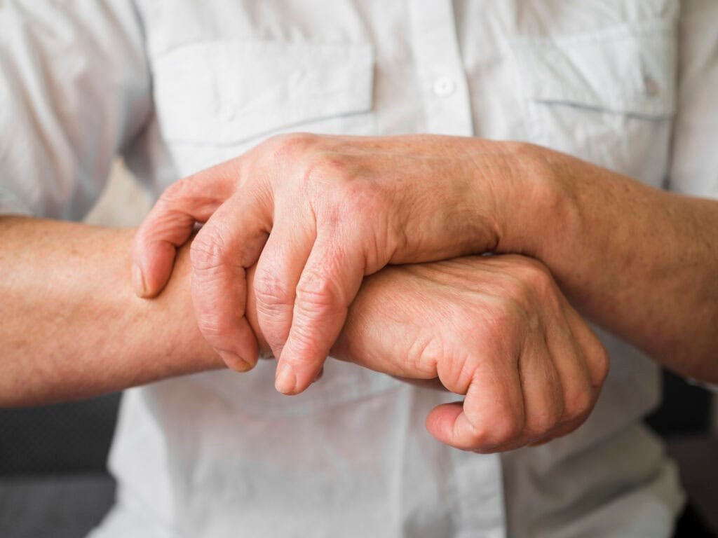 rheumatoid arthritis treatment